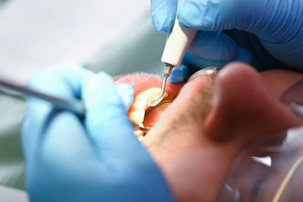 Best Emergency Treatment for Dental Infections or Abscesses in Groveland, ID